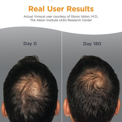 Viviscal Men's Hair Growth Supplements for Thicker Fuller Hair, Clinically Proven Collagen Complex, 180 Tablets 3 Month Supply