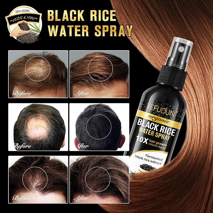Organic Black Rice Water Spray for Hair Growth, A Solution with Castor Oil & Ginger Root Extract for Thicker, Fuller Hair, Targets Hair Loss and Repairs Damage 100ml/3.2 fl.oz (1 PC)