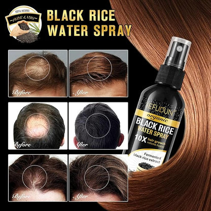 Organic Black Rice Water Spray for Hair Growth, A Solution with Castor Oil & Ginger Root Extract for Thicker, Fuller Hair, Targets Hair Loss and Repairs Damage 100ml/3.2 fl.oz (1 PC)