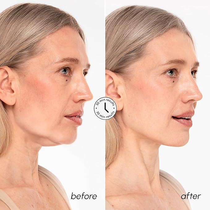 MAREE V Line Lifting Mask with 24K Gold – Deep Collagen Face Mask for Women – Jawline Shaper Mask with Retinol & Hyaluronic Acid – Neck Tightening & Firming - Double Chin Strap for Face Lift