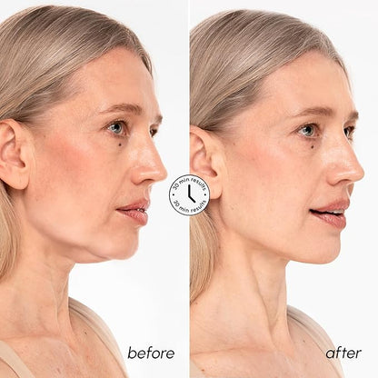 MAREE V Line Lifting Mask with 24K Gold – Deep Collagen Face Mask for Women – Jawline Shaper Mask with Retinol & Hyaluronic Acid – Neck Tightening & Firming - Double Chin Strap for Face Lift