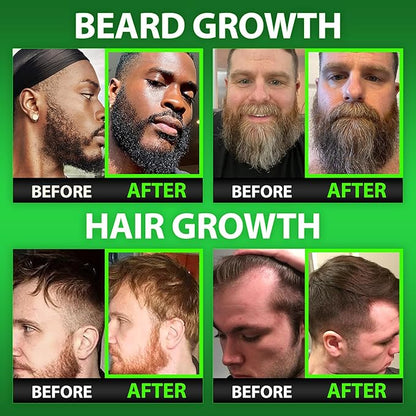 Biotin Gummies 620,000mcg + Liquid Biotin Drops with Collagen Peptides – Men's Beard Growth Kit for Thicker Fuller Beard – Beard & Hair Growth Vitamins with MSM, Keratin, Bamboo & Zinc