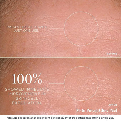 m-61 PowerGlow Peel | Exfoliating Facial Peel With Glycolic, Salicylic Acid. 1 Minute, 1 Step - 10 Treatments