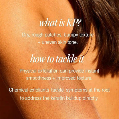 First Aid Beauty - KP Bump Eraser Body Scrub with 10% AHA, Keratosis Pilaris Skin Exfoliater with Glycolic and Lactic acids, Helps Reduce Chicken Skin Bumps, Safe for Sensitive Skin, 10 oz