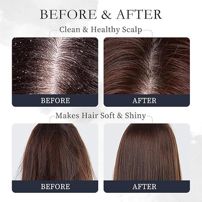Rosemary Hair Oil – Dry Scalp & Split End Treatment with Biotin & Essential Oils for Strengthening, Nourishing, Moisturizing & Supporting Longer, Healthier Hair