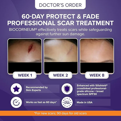 Advanced Scar Treatment with Silishield® & SPF 30 20g - Surgeon-Approved Silicone Scar Gel for Surgical Scars Ideal for Adults & Kids – New & Keloid Scar Treatment & Scar Removal Cream for Old Scars