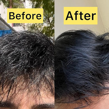 Pallure Transparent Hair Oil Treatment, To Support Thicker, Voluminous, Fuller Looking Hair, Infused with Hyaluronic Acid, Biotin, Avocado and Rosemary Oil (3.4 Fl Oz)