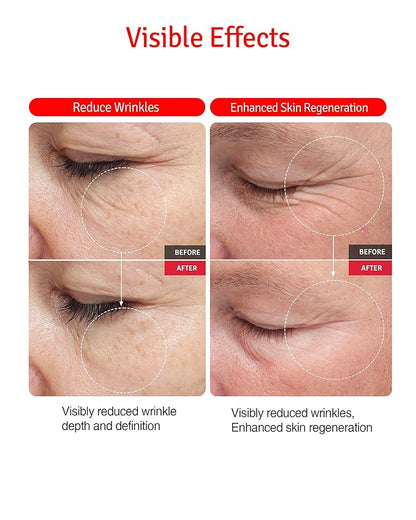 Wrinkle Serum - Anti Aging Booster Skin Rejuvenating Serum with Peptides, Vitamin C, Shea Butter - Wrinkle Repair, Tighten Pores, Smooth Skin Texture, Youthful Skin - Fragrance Free, 1.69oz.