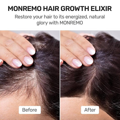Hair Growth Serum with Turmeric, Caffeine & Biotin – Fast-Absorbing Regrowth & Scalp Treatment Serum for Fuller Hair – Lightweight Vegan Formula – Ideal for Thinning, Weak Hair & Daily Use