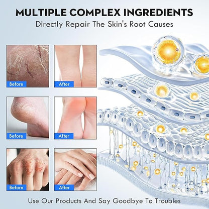 Urea Cream 40% Percent Foot Care Plus 2% Salicylic Acid 3.52 Fluid oz,Foot and Hand Cream Maximum Strength with Aloe Vera and Shea Butter,for calluses and Dry – 2-Pack