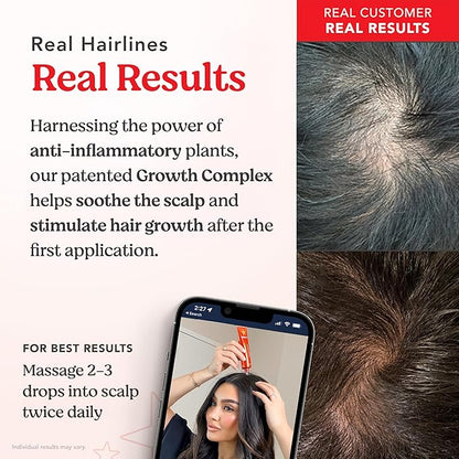 HAIRtamin Scalp Serum | Visibly Thicker, Nourished Hair and Healthy Scalp Treatment (Two Pack)