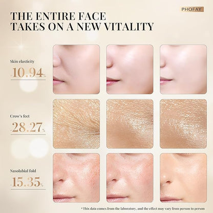 PHOFAY 4-in-1 Facial Device, 1.4oz Matching Gel. Multi Functional Beauty Device, Lifting, Firming, Puffiness Reduction and Promote Absorption & Soothing Care Calm Skin, Youthful Glow (Golden)