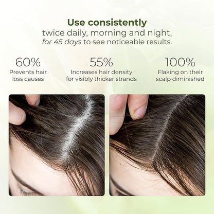 Cocoon Pomelo Grapefruit Oil Hair Tonic, Hair Growth Serum, Vegan Scalp Serum Treatment for Thinning, Damaged & Breakage Hair | Soften, Reduce Hair Loss & Promote Hair Growth | 4.73 fl oz