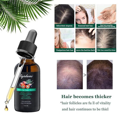 Tgideas Rosemary and Batana Oil Hair Oil Natural Plant Extracts - Nourishes Scalp and Strengthens Hair - Suitable for All Hair Types, Eyelashes and Eyebrows
