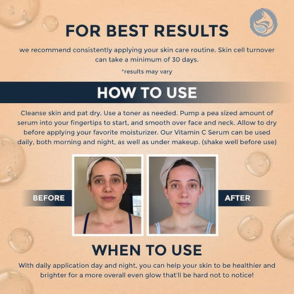 Foxbrim Naturals Vitamin C Face Serum 1oz – Stable Formula with Botanical Hyaluronic & Organic Jojoba for Dark Spots, Radiance, Hydration & Even Tone – Vegan Clean Beauty for Sensitive Skin, USA-Made