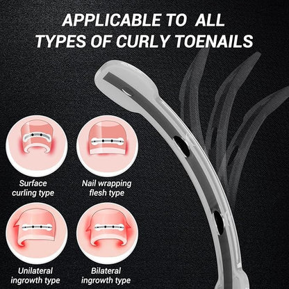 Titanium Alloy Ingrown Toenail Treatment, Nail Tools, and Ingrown Toenail Removal Kit Specially Designed for Curved Nail Repair and Ingrown Toenail Corrector (0.59/0.67in)