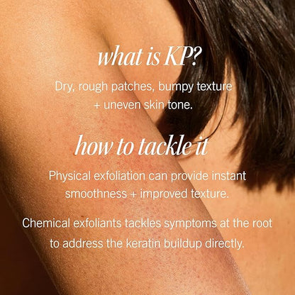 First Aid Beauty Smooth + Juicy Body Scrub Kit: KP Bump Eraser Body Scrub with 10% AHA, Daily Exfoliation Keratosis Pilaris Set to Help Reduce Chicken Skin Bumps; Strawberry, Peach, & Original (2 oz)