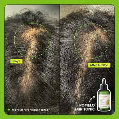 Cocoon Pomelo Grapefruit Oil Hair Tonic, Hair Growth Serum, Vegan Scalp Serum Treatment for Thinning, Damaged & Breakage Hair | Soften, Reduce Hair Loss & Promote Hair Growth | 4.73 fl oz